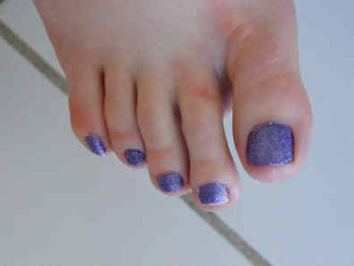 toe nails